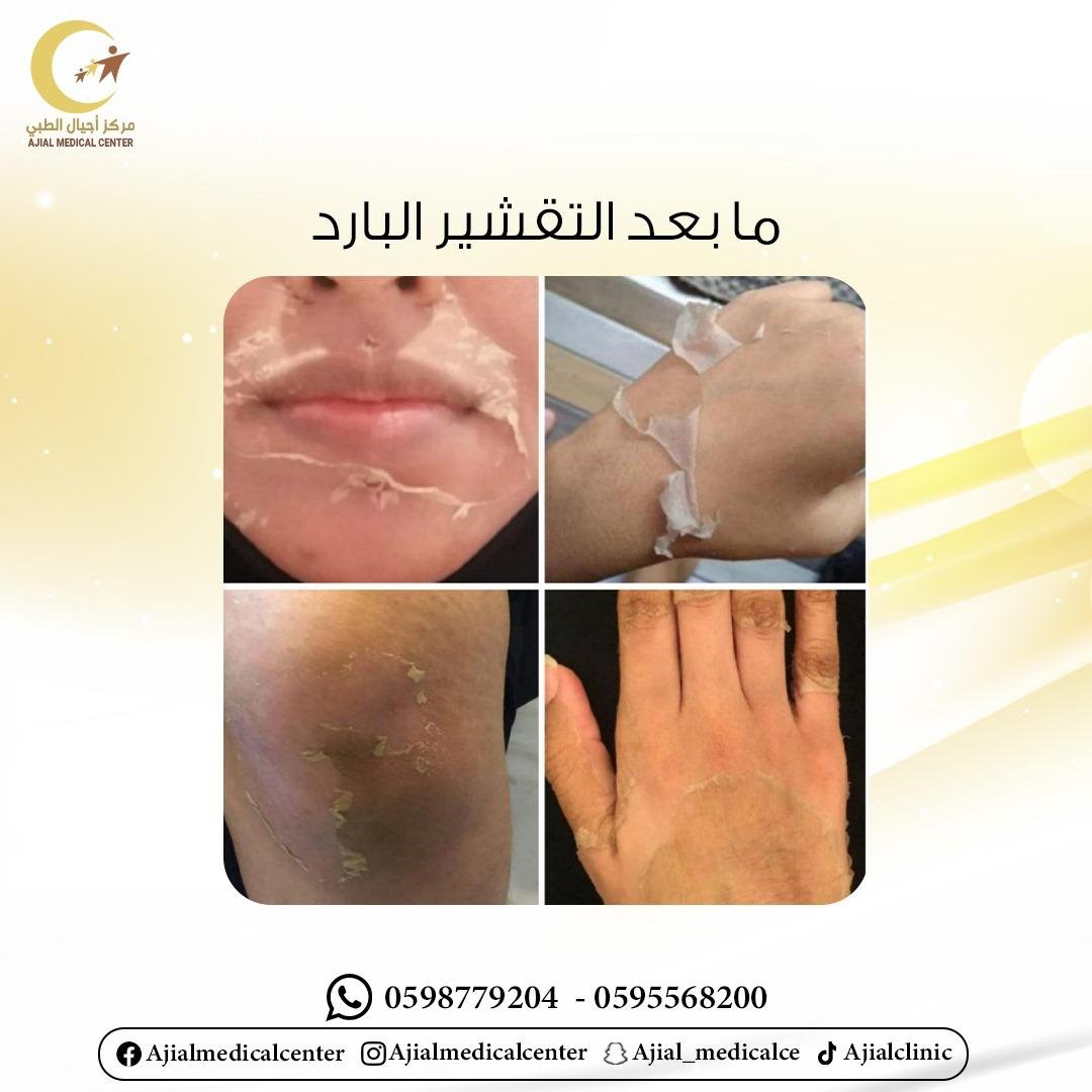 باقات العناية بالبشرة